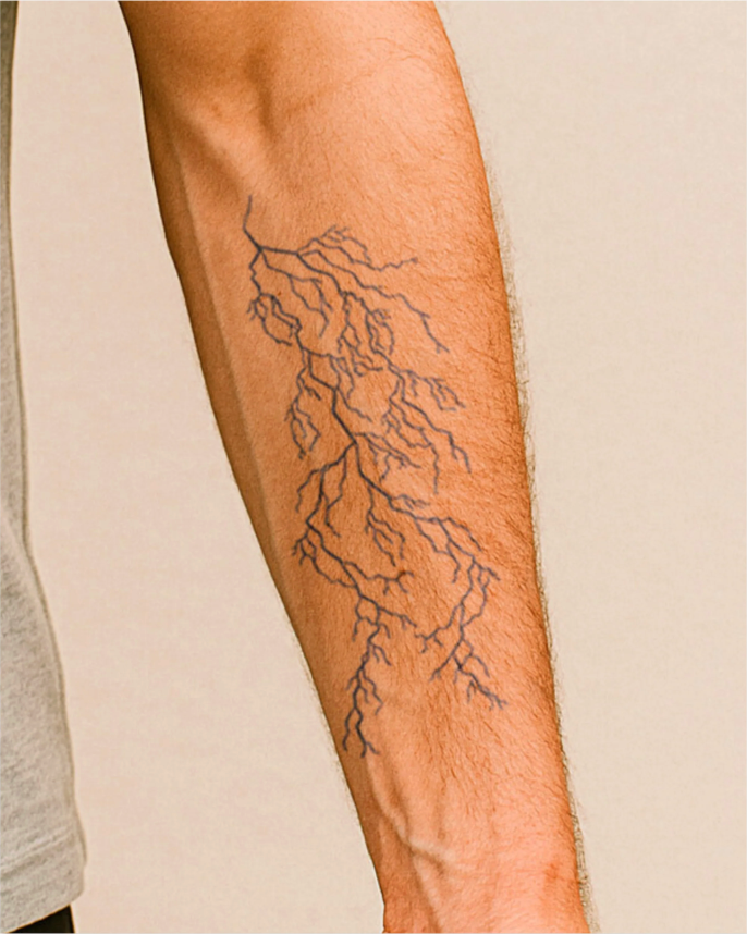 Arbre de foudre