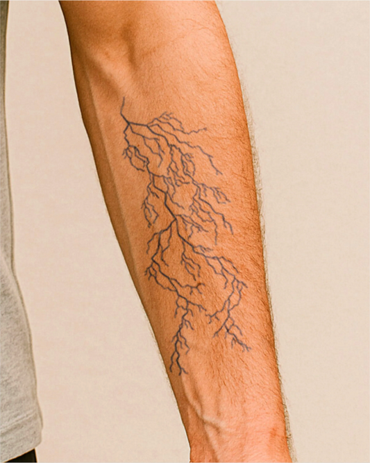 Arbre de foudre